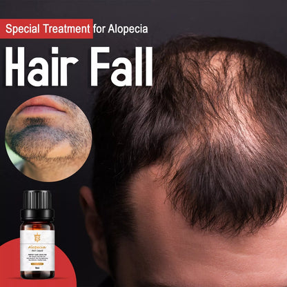 ALOPECIA ANTI HAIR LOSS TREATMENT FOR HAIR FALL,BEARD\BROW LOSS 10ML UK