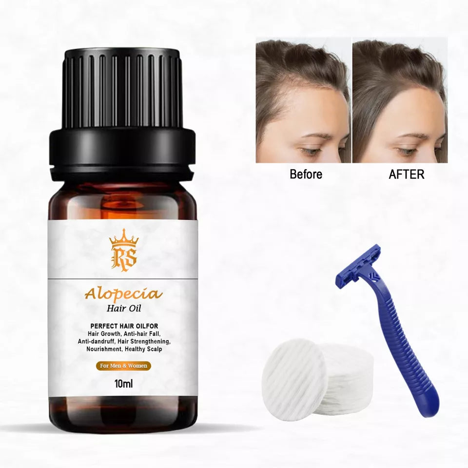 ALOPECIA ANTI HAIR LOSS TREATMENT FOR HAIR FALL,BEARD\BROW LOSS 10ML UK