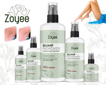 Zoyee Bump Remover Ingrow Hair Treatment Fast Delivery UK